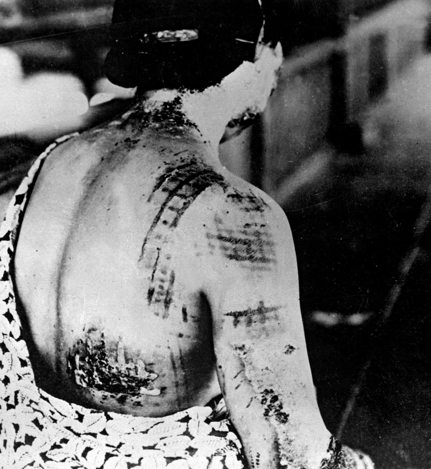 Navigating The Dangers Of Radiation Poisoning